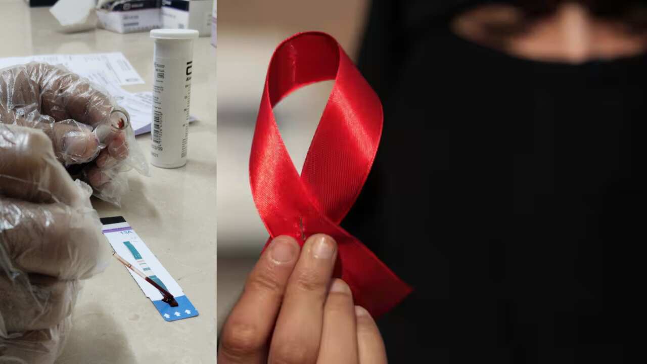 HIV AIDS_01122024